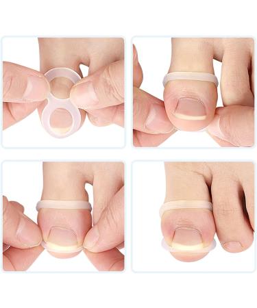 Silicone Ingrown Toe Nail Corrector Quick Relief and Effective Recovery for Ingrown Toenail Care Transparent Silicone Material - Buy Online on GoSupps.com
