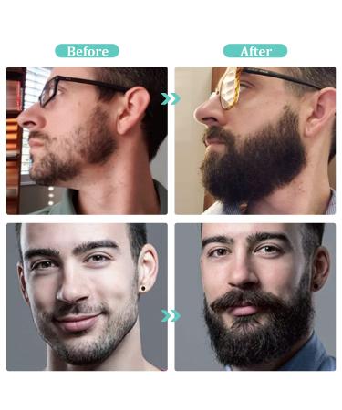 Beard Growth Kit with Derma Roller, Oil, Balm, Comb - Perfect Gift for Men - Fathers Gifts for Dad - Buy Online on GoSupps.com