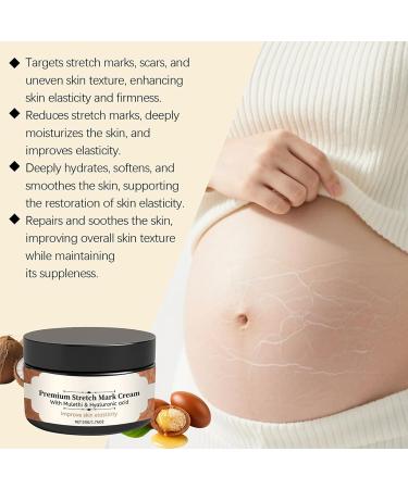 Stretch Mark Cream for Pregnancy - 50g Pregnant Belly Cream - Non-Greasy Moisturizer Prevents Stretch Marks and Improves Elasticity - Buy Online on GoSupps.com