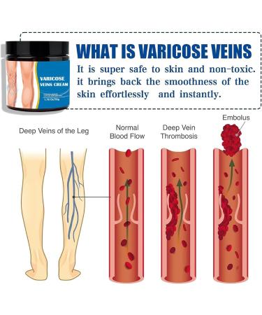 Leg Cream - Muscle Warming Cream | Foot Detox | Slow-Relieving Natural Lotion 50g | Reduces Swollen Calves for Women Ideal for Teachers - Buy Online on GoSupps.com