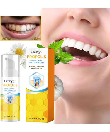 Propolis Mouth Cleaning Foam 60ml - Natural Oral Care for Fresh Breath | International Shipping Available - Buy Online on GoSupps.com