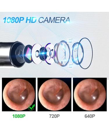 Golden Otoscope Ear Wax Remover - Ultra-Thin HD 1080p Endoscope with 6 LED Lights for iPhone iPad & Android - Safe for Kids & Adults - Buy Online on GoSupps.com