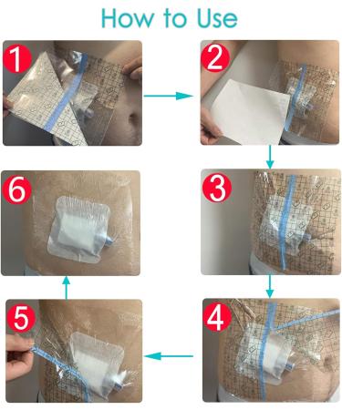 Waterproof Shower Protector for Catheter & Chemo Port | 10x12 Inch Dialysis Cover (Pack of 7) - Non-Glue Design for PICC Line & PD Accessories - Buy Online on GoSupps.com