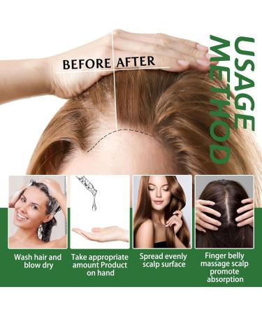 Huile de romarin pour la croissance des cheveux renforce les cheveux nourrit le cuir chevelu 2 x 60 ml - Buy Online on GoSupps.com