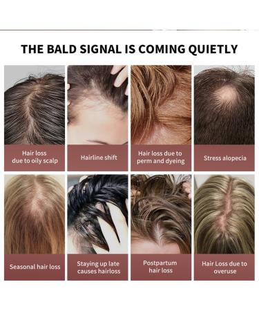 Baorder 100ML Raw Batana Oil for Healthy Hair 100 Natural Pure Unrefined and Authentic Cold Pressed Organic Sebi Batana Oil from Honduras Prevents Hair Loss Restores Damaged Hair - Buy Online on GoSupps.com