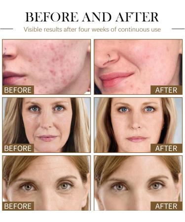 Ascorbyl Gluco-side Solution 12% Hyaluronic Acid Serum Dark Spot Remover for Face Skincare Serum Anti Aging Serum for Women Brightening & Hydrating Serum Face Serum for All Skin Types - Buy Online on GoSupps.com