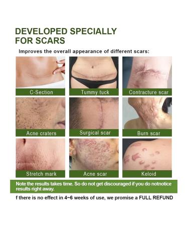 Proregen Medical Grade Scar Removal Spray - Advanced Formula for All Types of Scars (1pcs) - Buy Online on GoSupps.com