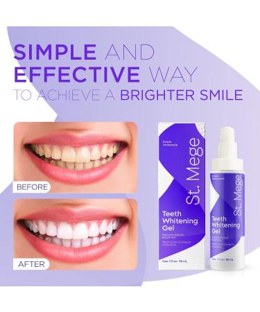 St. Mege Purple Toothpaste | Teeth Whitening Gel with Color Wheel Technology | Gentle Formula for Adults | Stain Removal & Brightness Booster | 1 fl oz - Buy Online on GoSupps.com