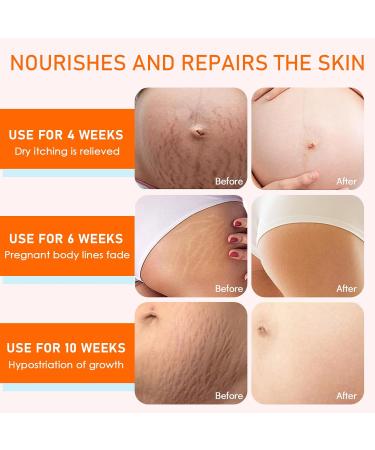 okalabandee Skin care oil pregnancy oil helps remove stretch marks and scars helps with dry skin firming skin oil in premium quality for skin care 125 ml - Buy Online on GoSupps.com