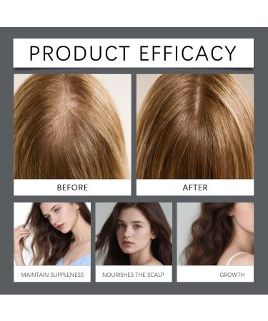  QPJUVC Amino Acid and Rosemary Shampoo for Hair Growth Thickening and Strengthening Shampoo for Thinning Hair Smooth and Shiny Hair (3) - Buy Online on GoSupps.com