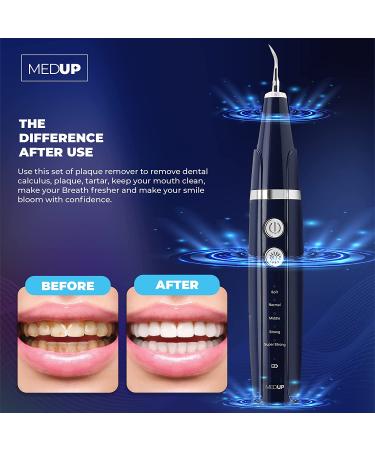 Plaque Remover & Teeth Cleaning Kit for Adults and Kids - Tartar & Stain Remover - 1 Count - Buy Online on GoSupps.com