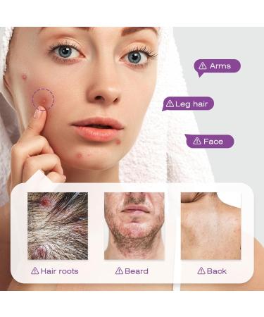  Generisch Itchy Scalp Relief 20g Moisturizer Soothing Scalp Care | For Daily & Seasonal Care At Home On The Go For Men & Women - Buy Online on GoSupps.com