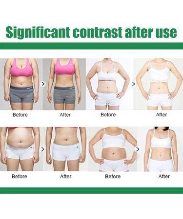  Eastuy Fast-Acting Cellulite Cream for Thighs and Buttocks | Firming and Skin-Toning Lotion - Anti-Cellulite Cream for Thighs and Buttocks Firming Body Lotion - Buy Online on GoSupps.com