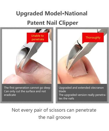 CHJHJKG Nail Clippers (Beauty) Nail Groove Special Nail Scissors Oblique Mouth Olecranon Toenails Clipper Inlaid Nail Nail Clipper Pedicure Manicure Tool - Buy Online on GoSupps.com