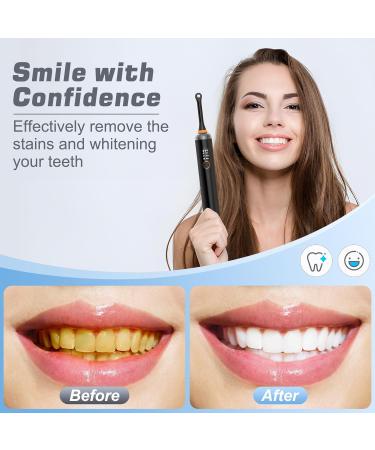 HOTOIQ Tooth Polisher Teeth Whitening Kit with 5 Heads Multifunctional Teeth Cleaning Kit for Daily Cleaning & Teeth Whitening for People/Pets USB Charging 3 Working Modes (Black) - Buy Online on GoSupps.com
