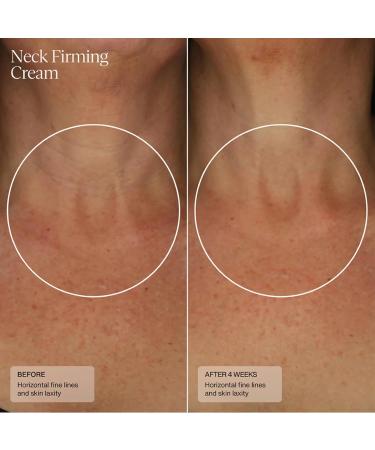 Buy Sent Neck Firming Cream - Advanced Anti-Aging Lift Cream with HSA Caffeine & Vitamin C | 1.7 Oz - International Shipping Available - Buy Online on GoSupps.com