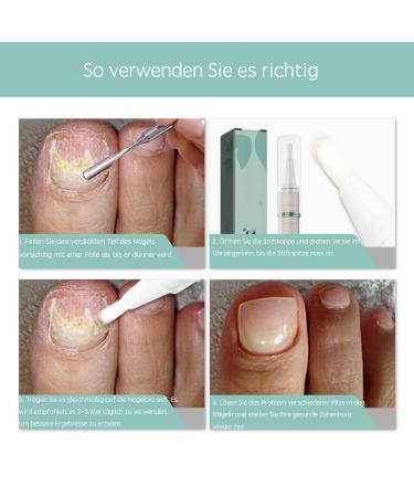 Nail Care Pen for Nail Fungus Treatment | Health Nail Care Pen (3PC) | Effective Nail Fungus Solution - Buy Online on GoSupps.com