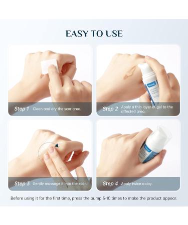 Mebak Silicone Scar Gel - Scar Therapy for Old and New Scars - 30g - Buy Online on GoSupps.com