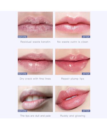 Lip Scrub Exfoliator Lip Lightening Lip Scrub Moisturizer Lip Care Lip Mask to Remove Dead Skin Lip Lightening For Dark Lips Lip Exfoliator Scrub for Chapped & Cracked Lips for Lip Repair - Buy Online on GoSupps.com