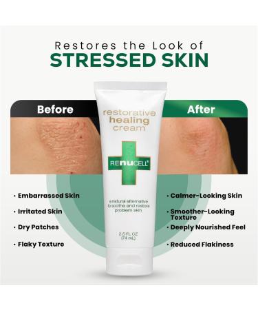 Renucell Restorative Healing Ointment for Itchy and Dry Skin with Natural PHYOXOLIN Moisture Barrier Skin Repair Cream to Soothe Cracked Irritated Skin on Face & Body 2.5 oz - Buy Online on GoSupps.com