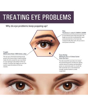 Eye Cream Under Eye Cream for Dark Circles Eye Bags Remover More Young Eyes - Buy Online on GoSupps.com