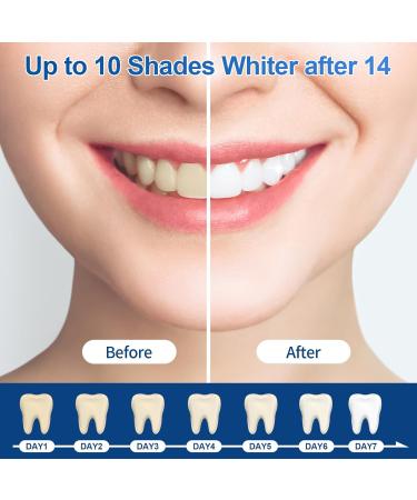 44% Ganencsnc 10 Syringes (3ml) - Teeth Whitening Gel Refills - Strong 44% Carbamide Peroxide Formula - Compatible with Teeth whitening Kit-Teeth Whitener for Coffee & Wine Stains - Buy Online on GoSupps.com