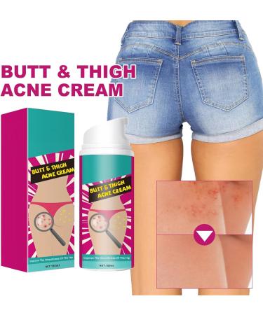  Eazerom 14 Cream for Pimple Removal on Glutees 100ml Ass Acne Cream Glutees Pimple Reduction Removes Pimple and Redness for Glutei and Coscebutt - Buy Online on GoSupps.com