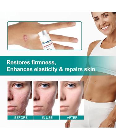 IBUGER Scarremove Advanced Scar Spray - Medical Grade Scar Remover for All Types of Scars | 1pcs - Buy Online on GoSupps.com