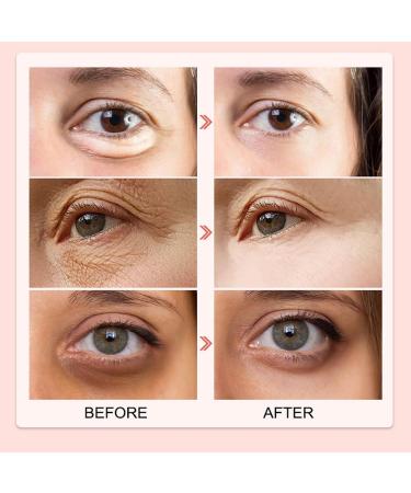 Eye Cream for Dark Circles and Puffy Eyes - Caffeine Eye Cream - Eye Cream Anti Aging for Eye Bags - Improve Eye Area Concerns - Anti Wrinkle Eye Cream Aiming at Lightening Eye Lines - Buy Online on GoSupps.com