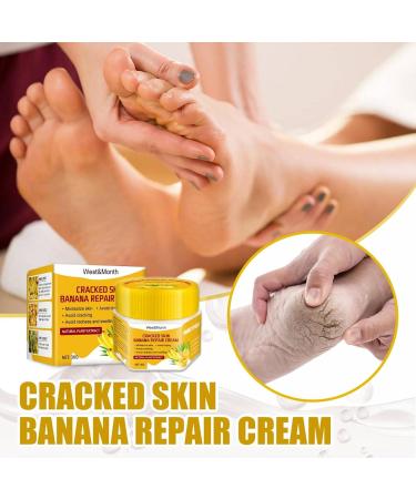 Shea Butter Foot Cream for Very Dry Feet & Cracked Heels - Effective Ointment for Soft Skin | A Size - Buy Online on GoSupps.com