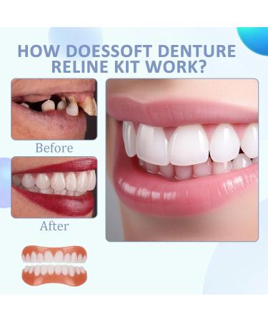 Biancat & Yunpso Perfect Fit Denture Silicone Reline Kit - Soft Denture Reline Kit for Men & Women (2 Set) | International Shipping Available - Buy Online on GoSupps.com