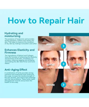 KOAHDE Retinol Anti-Age Cream for Men Retinol Men's Face Cream Retinol Anti-Wrinkle Cream for Men Men's Anti-Aging Anti-Wrinkle Cream Anti-Wrinkle Face Cream with Hyaluronic Acid and Pro-Retinol 50ML - Buy Online on GoSupps.com