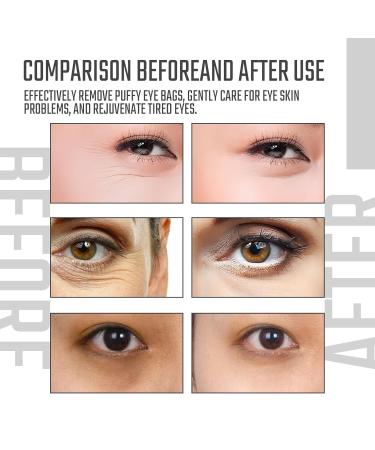 Instant Anti-Aging Eye Serum with Glycerin and Collagen Visibly Reduces Dark Circles Wrinkles and Puffiness for a Revitalized Look Lightweight Fast-Absorbing Formula for Daily Use 1 FL.OZ - Buy Online on GoSupps.com