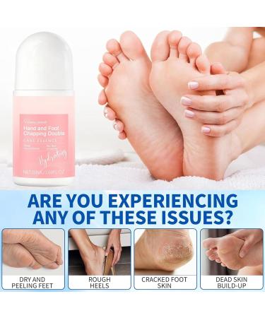 Dry & Cracked Heel Liquid - Natural Moisturizer Roll-On 50ml For Dry Feet Non Greasy Fluid For Cracked Heels | For Hands Elbows Knees Pedicure Rough Night Beauty - Buy Online on GoSupps.com