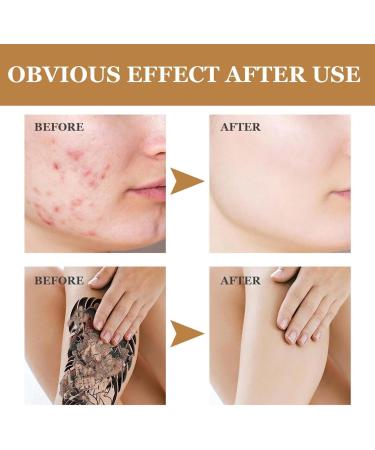 Tattoo Concealer Body Makeup Concealer Body Makeup Concealer Body Makeup Waterproof No Transfer Body Makeup Lotion Body Makeup To Cover Tattoo (1 Piece M) - Buy Online on GoSupps.com