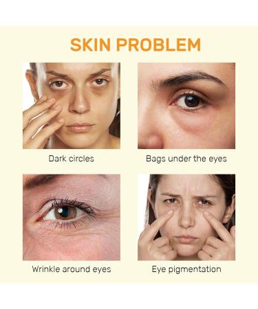 Vitamin C Eye Cream - Reduce Dark Circles Puffiness & Fine Lines | Anti-Aging Under Eye Cream (0.7 FL.Oz - Buy Online on GoSupps.com