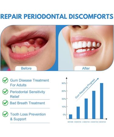Periodontal Disease Treatment -1.7% Hydrogen Peroxide Gel for Bleeding Gums Gum Repair Bad Breath - 3.52 Ounce Tube - Buy Online on GoSupps.com