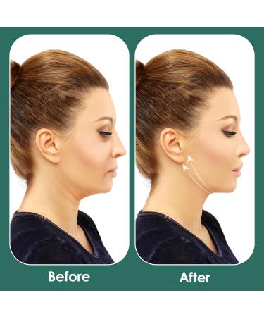 Double Chin Reducer ihohi Facial Cheek V Line Lifting Up Bandage Patch Facial Slimming Strap Reusable Facial Shaped UP Lift Belt for Women Tightening Skin Preventing Sagging - Buy Online on GoSupps.com