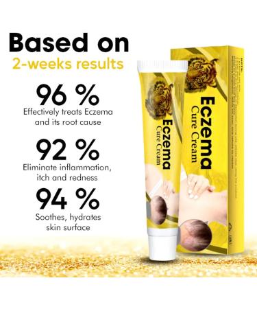 EXQST Eczema Treatment Cream Eczema Relief Cream Eczema Psoriasis Cream Tinea Versicolor Treatment Cream to Relieve Irritated Skin - Buy Online on GoSupps.com