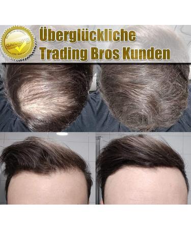  Trading Bros Hair Trading Bros Instant Thickening Thick Hair 28g Dark Brown XXL - Buy Online on GoSupps.com