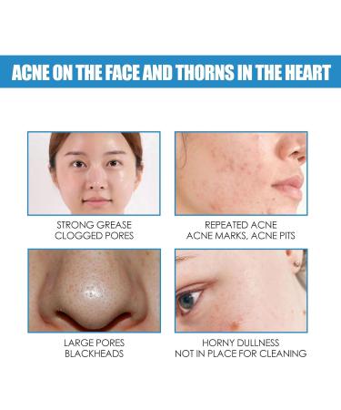 B5 Soothing Repairing Cream - Strengthen Skin Barrier Repair Acne-Prone Skin Improve Roughness | 40ml - International Shipping Available - Buy Online on GoSupps.com