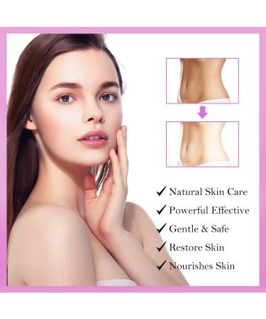 LOVOOD Dark Spot Corrector Cream - Underarm, Neck, Elbow, Private Areas - Instant Results, 2 oz (Upgraded Formula) - Buy Online on GoSupps.com