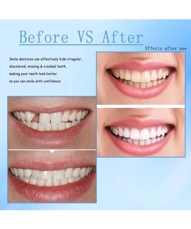 2 Pairs Artificial Teeth - Brighten Cosmetic Veneers for Men & Women | Immediate Dentures & Plug-In Solutions - Buy Online on GoSupps.com
