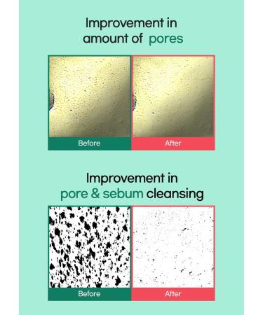 BRING GREEN Tea Tree Cica Pore Clay Pack | Vegan Deep Pore Cleansing Clay Mask for Pore Purifying Contains Cica & Tea tree for Soothing & Relieving Stressed Skin 4.23 oz. - Buy Online on GoSupps.com