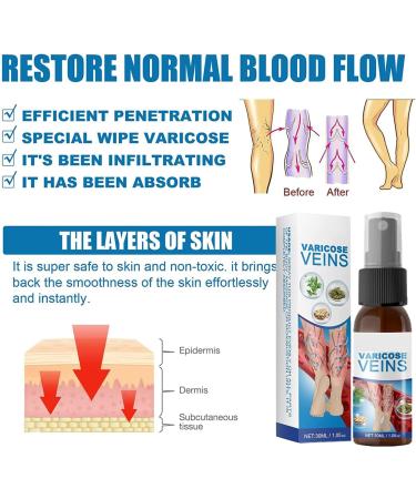 Veinhealing Varicose Veins Treatment Spray - 30 ml (3 Pack) for Effective Relief & Healing | Best Varicose Veins Solution for Legs - Buy Online on GoSupps.com