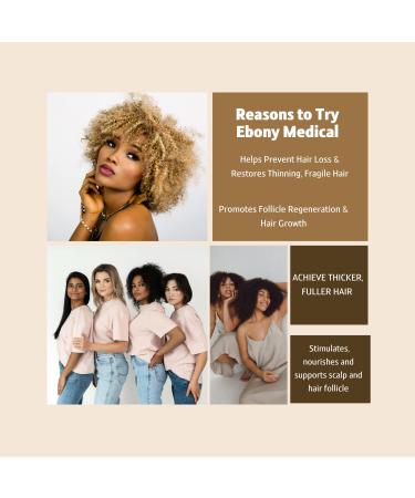 Alopecia Areata Treatment Hair Loss Shampoo - Best Hair Growth Solution for Thinning Hair & Receding Hairlines - 12 fl oz - Buy Online on GoSupps.com