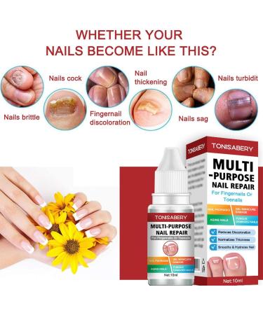 Toenail Repair Solution Extra Strong Finger and Toenail Repair Fluid 10 ml nail repair serums for toenail or fingernail repair and renew nail damage Yunmiao - Buy Online on GoSupps.com