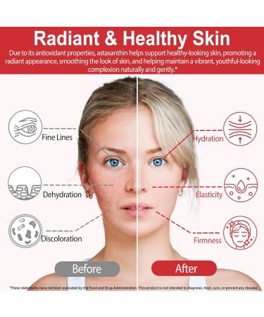 ABOUME Astaxanthin Supplements Astaxanthin 12mg Fresh Microalgae Source Supports Eye Immune Skin Health Internal Circulation | Non-GMO | No Gluten (2PCS) - Buy Online on GoSupps.com