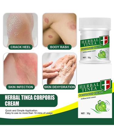 Anshka Herbal Tinea Corporis Cream - Skin Relief & Itching Relief Ointment - Buy Online on GoSupps.com