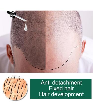 Ginger hair growth oil 30 ml ginger hair growth essential oil ginger hair treatment oil hair growth solution essential oil against hair loss shampoos - Buy Online on GoSupps.com